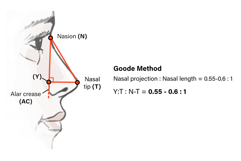 Goode Method for evaluating nasal tip projection