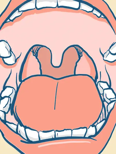 Pediatric Otolarygology